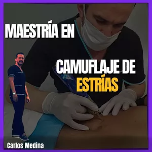 MAESTRIA EN CAMUFLAJE DE ESTRÍAS VALE A PENA