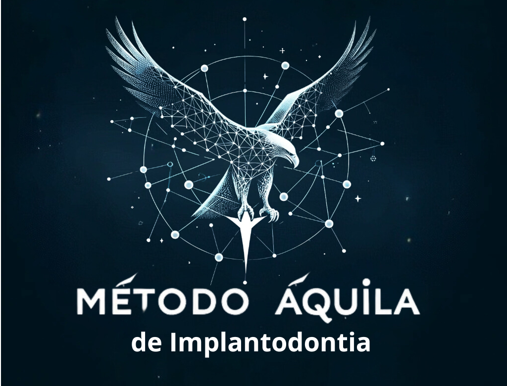 METODO AQUILA DE IMPLANTODOLOGIA VALE A PENA